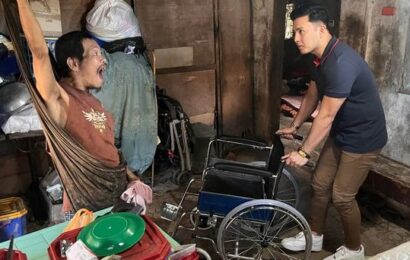 VGob Alex naghatid-tulong sa isang Dystonia patient
